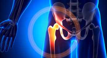 Is Hip Pain Keeping You Down?